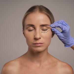Estetica e Sorriso "Blefaroplastica Inferiore in Albania"