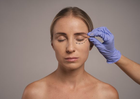 Estetica e Sorriso "Blefaroplastica Inferiore in Albania"