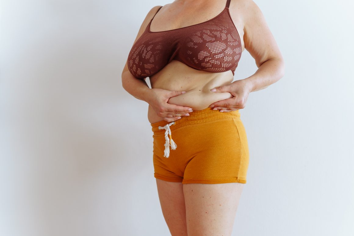 Estetica e Sorriso "Mommy MakeOver in Albania"