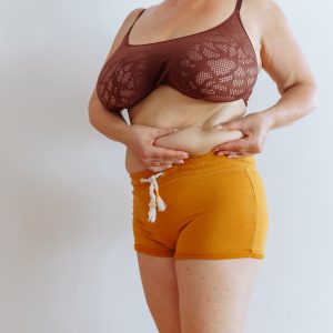 Estetica e Sorriso "Mommy MakeOver in Albania"