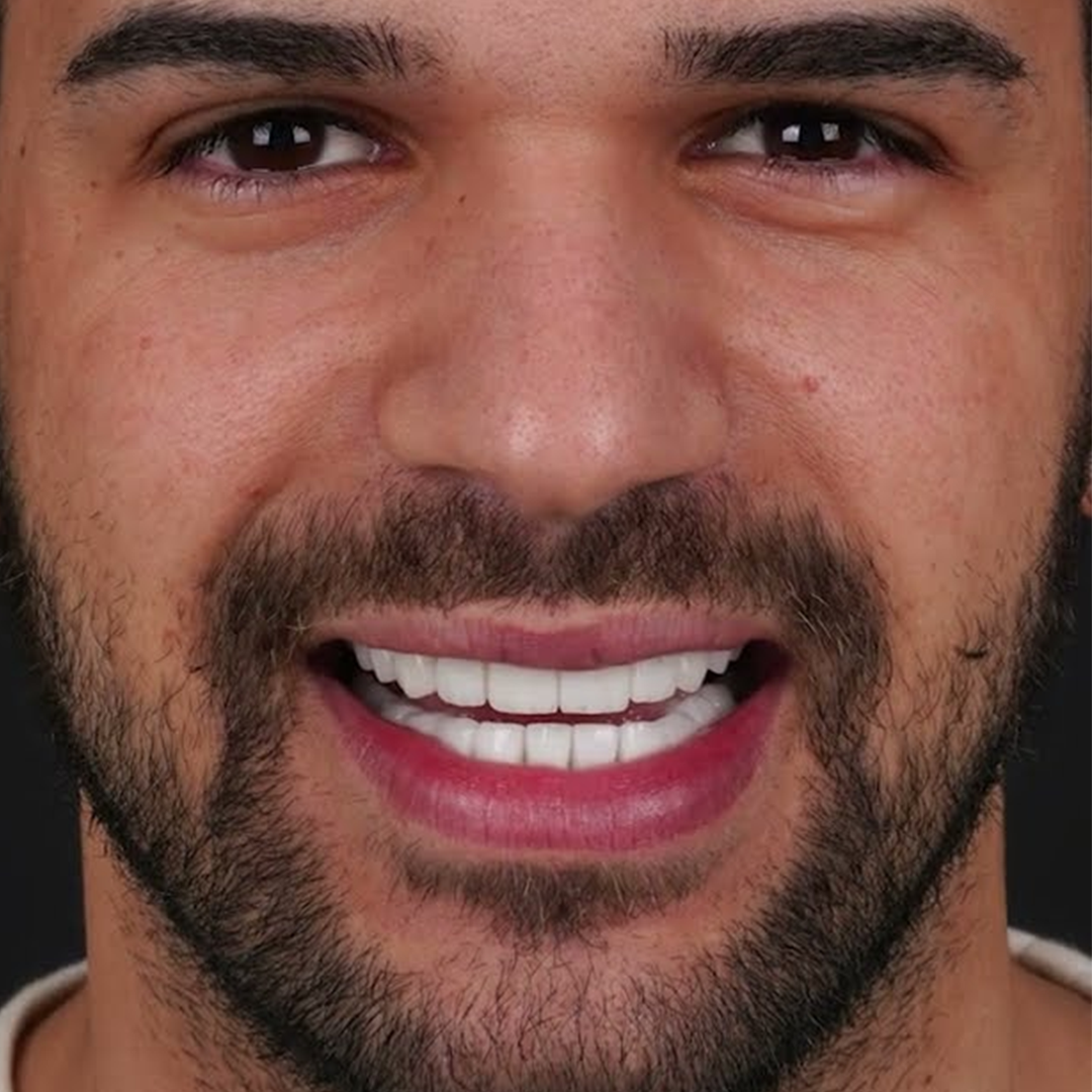 Estetica e Sorriso "Hollywood Smile in Albania"