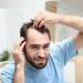 Scopri quanti capelli si perdono al giorno e quando preoccuparsi. Estetica e Sorriso in Albania ti guida nella cura dei capelli.