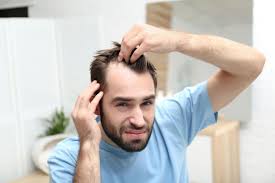 Scopri quanti capelli si perdono al giorno e quando preoccuparsi. Estetica e Sorriso in Albania ti guida nella cura dei capelli.