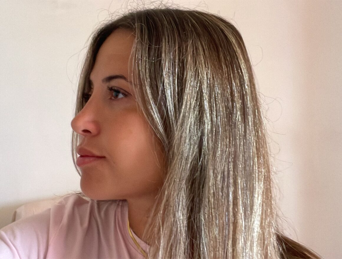 Estetica e Sorriso - Rinoplastica in Albania