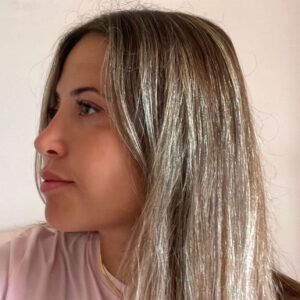 Estetica e Sorriso - Rinoplastica in Albania - Estetica e Sorriso Estetica e Sorriso - Rinoplastica in Albania