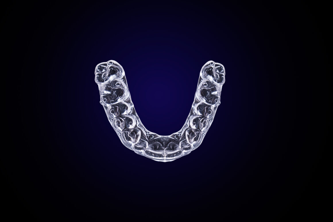 Estetica e Sorriso - Mascherini Invisalign