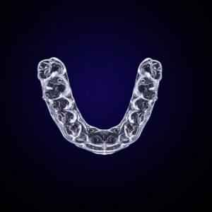 Estetica e Sorriso - Mascherini Invisalign
