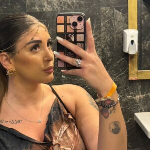 Rinoplastica in Albania - Estetica e Sorriso