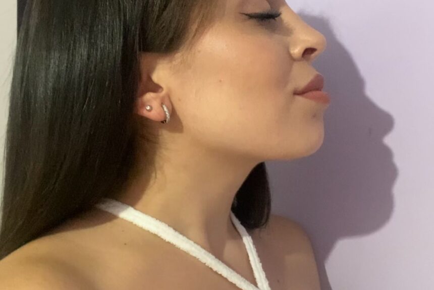 Estetica e Sorriso - Rinoplastica