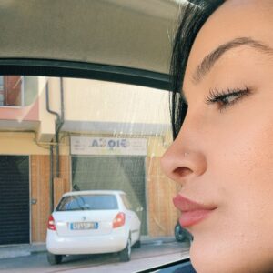 Rinoplastica in Albania - Estetica e Sorriso