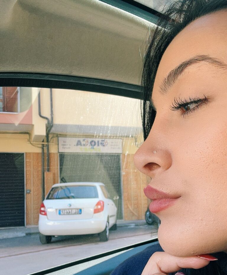 Rinoplastica in Albania - Estetica e Sorriso
