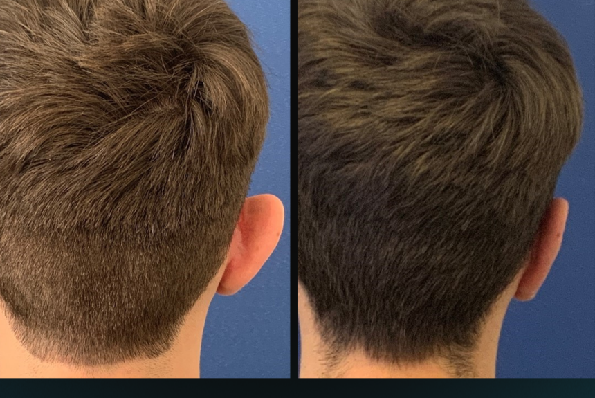 Otoplastica - Estetica e Sorriso