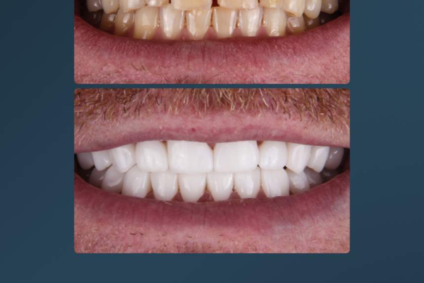 Hollywood Smile - Estetica e Sorriso