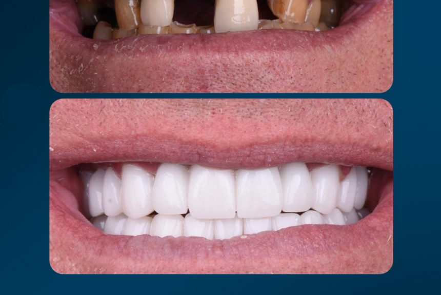 Hollywood Smile - Estetica e Sorriso