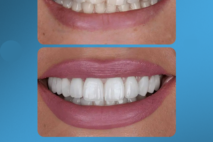 Impianti Dentali - Estetica e Sorriso