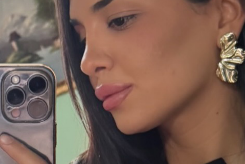 Rinoplastica - Estetica e Sorriso