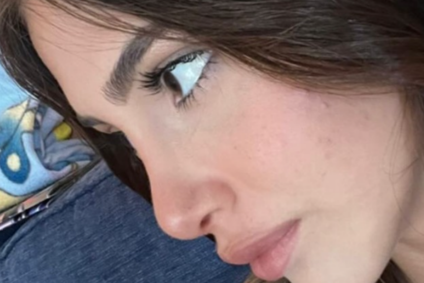 Rinoplastica - Estetica e Sorriso