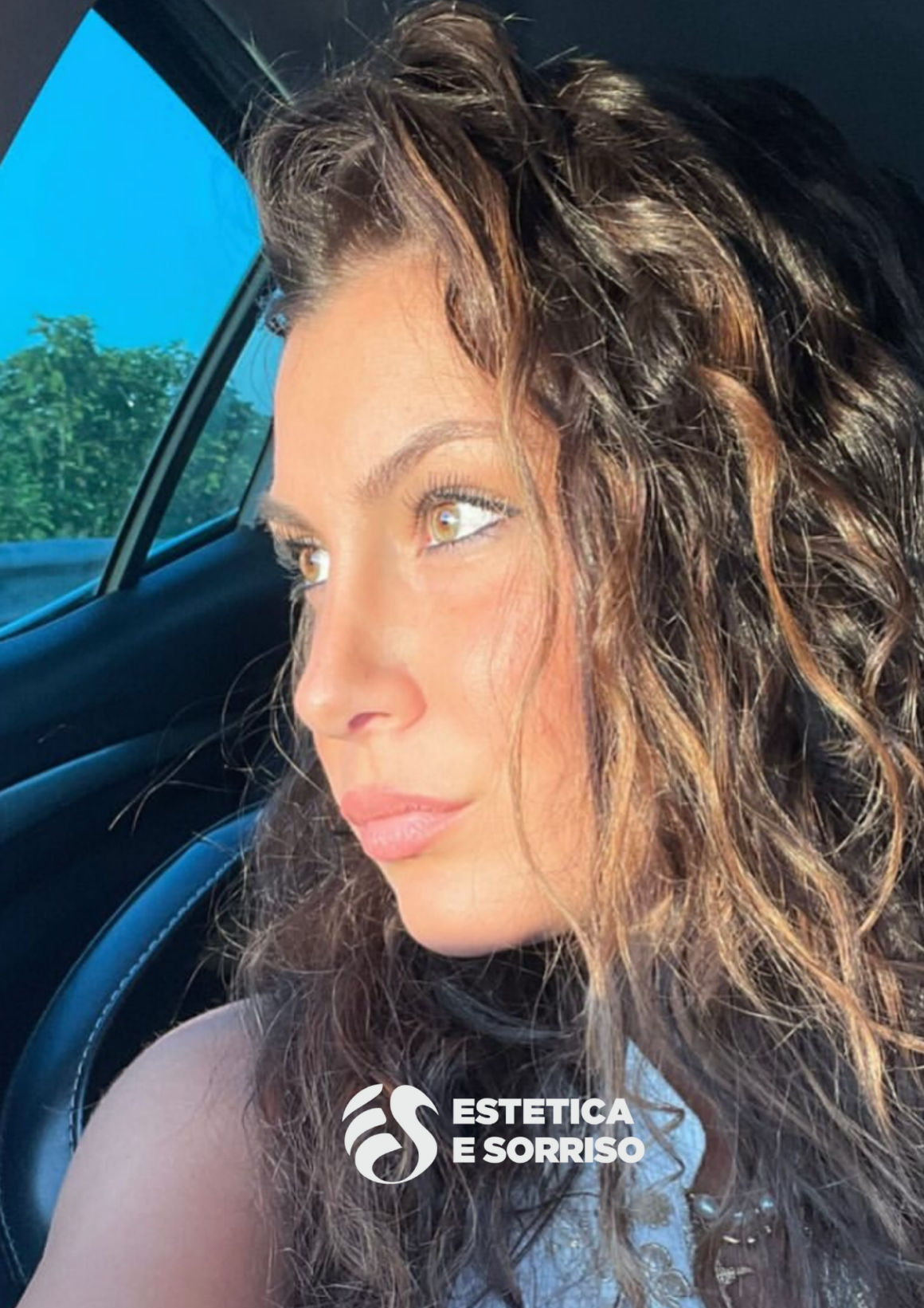 Rinoplastica - Estetica e Sorriso - Estetica e Sorriso Rinoplastica - Estetica e Sorriso