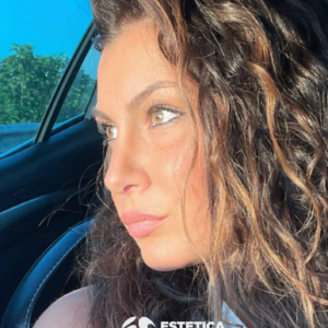 Rinoplastica - Estetica e Sorriso