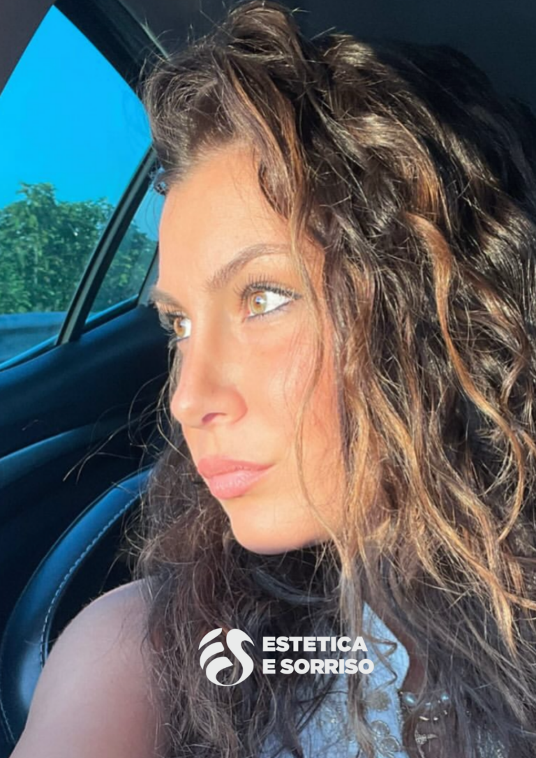 Rinoplastica - Estetica e Sorriso