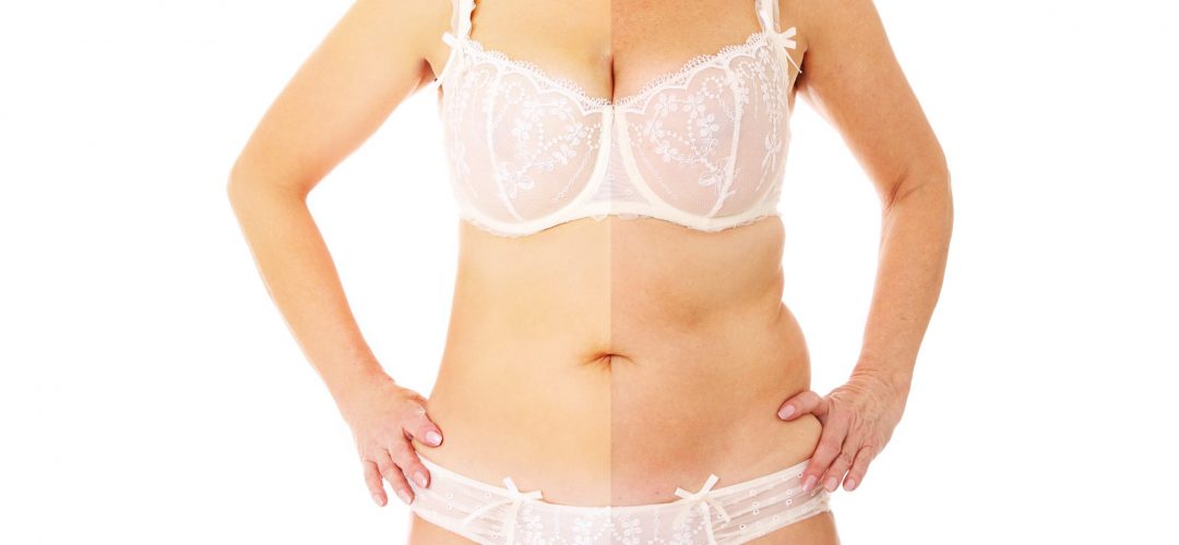 Estetica e Sorriso “Liposcultura in Albania” Estetica e Sorriso "Liposcultura in Albania"