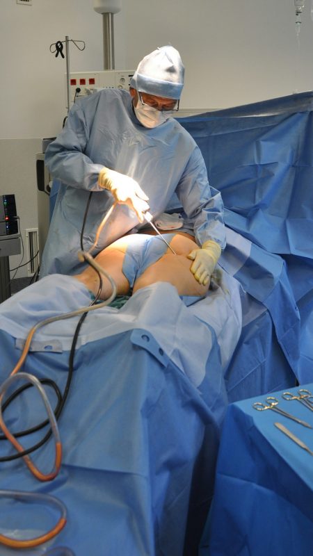 Estetica e Sorriso "Brazilian Butt Lift in Albania"