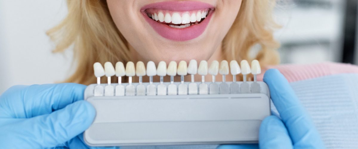 Estetica e Sorriso “Faccette eMax in Albania” Estetica e Sorriso "Faccette eMax in Albania"