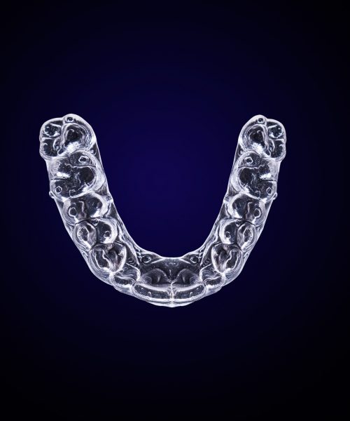 Estetica e Sorriso "Mascherine Invisalign in Albania"